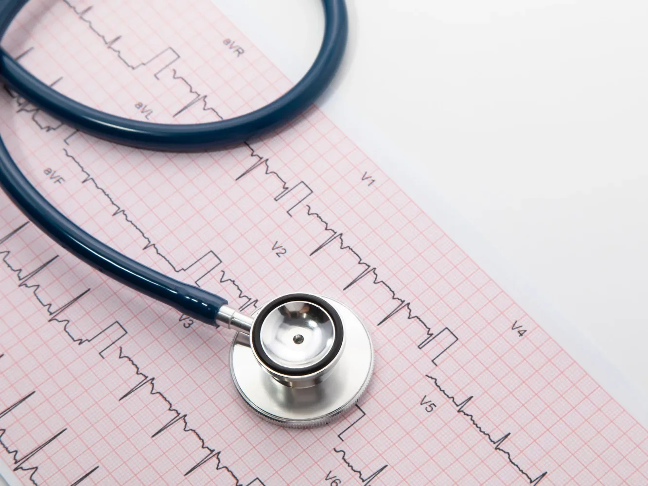 Electrocardiograma